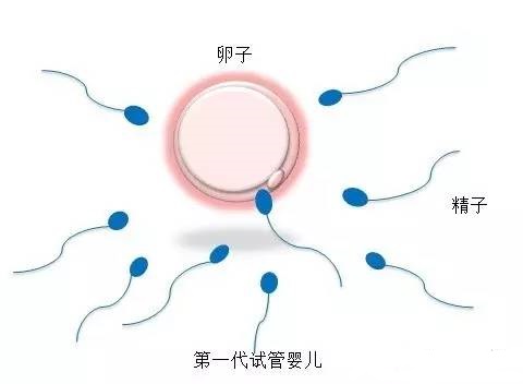 冷冻